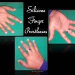 Silicone Finger Prostheses
