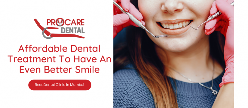 Affordable Dental Treatment To Have An Even Better Smile