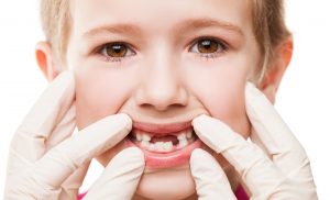 Oral health problems in children