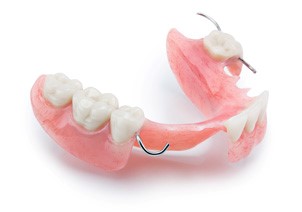 acrylic tooth treatment