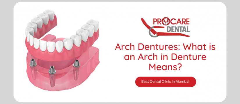 Arch Dentures: What is an Arch in Denture Means?
