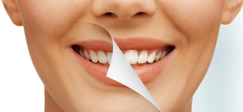 Cosmetic Dentistry: What can be corrected with cosmetic dentistry?