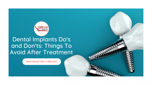 Dental Implants Do's and Don'ts: Things To Avoid After Treatment