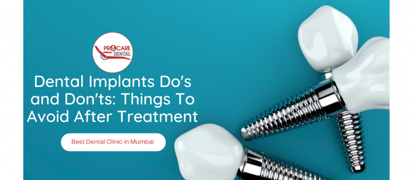 Dental Implants Do's and Don'ts: Things To Avoid After Treatment