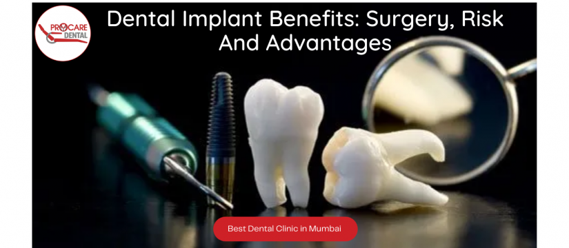 Dental Implant Benefits: Surgery, Risk And Advantages