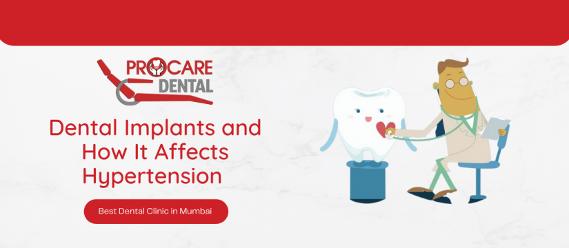 Dental Implants and How It Affects Hypertension