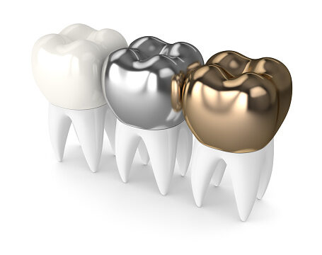 Different Types of Dental Caps